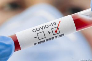 Қазақстанда тағы 158 адам коронавирус инфекциясын жұқтырды