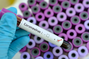 Қазақстанда соңғы тәулікте 800-ден астам адам коронавирус індетін жұқтырды