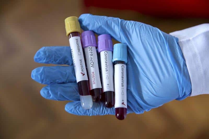 Елімізде коронавирус инфекциясын жұқтырғандар саны 700-ден асты